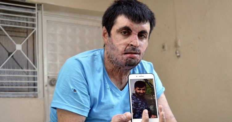 Mehmet Nafi Özdemir’in sağlığına kavuşması için gereken para toplandı